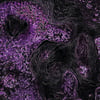 Types of Lung Cancer in microscrope